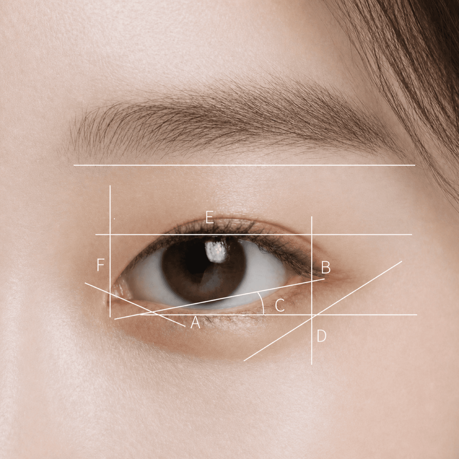 마침표성형외과의 눈매 정밀 진단 — 6가지 균형 지표(A·B·C·D·E·F)를 표시한 측정 가이드