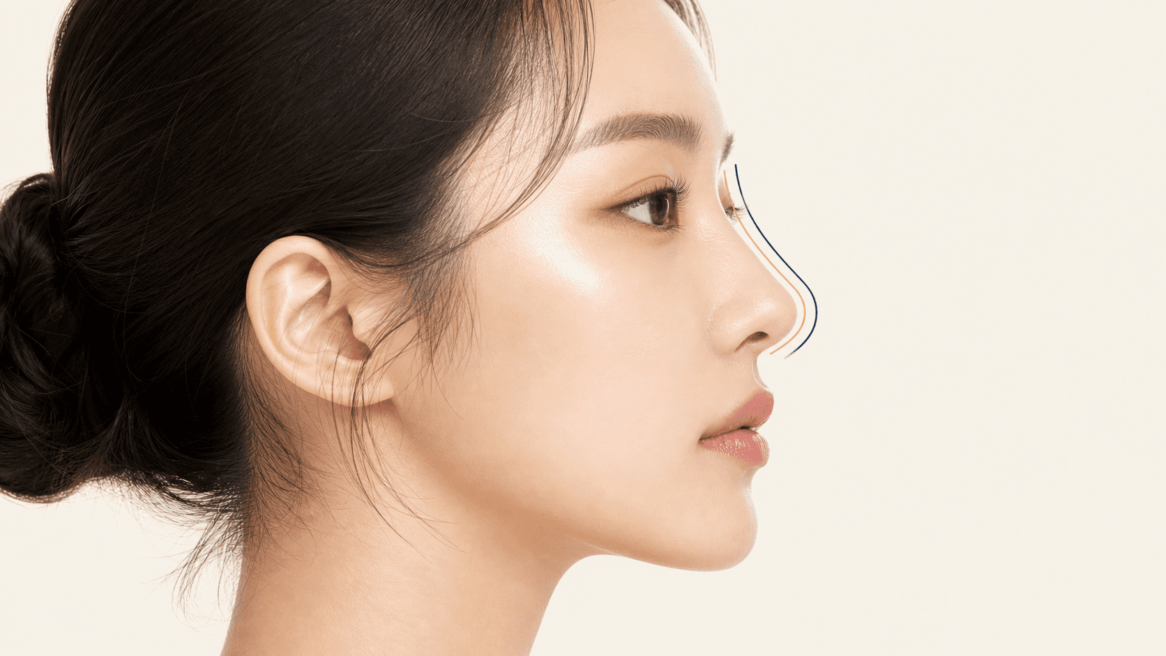 마침표 코성형
