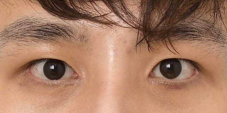 남자 자연쌍 - After